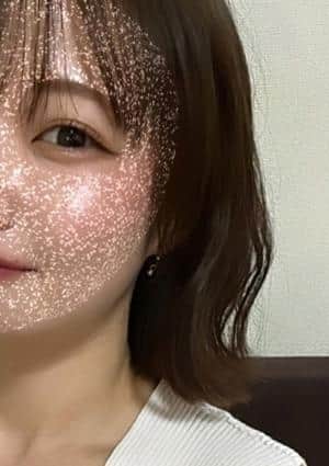 のんの画像